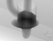 X-ray image of a THT solder joint with unsufficient hole fill according to IPC-A610